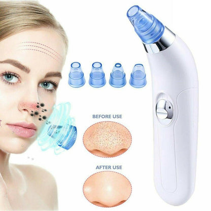 Limpiador de Poros Facial 007MAR2020 - Marina Hogar